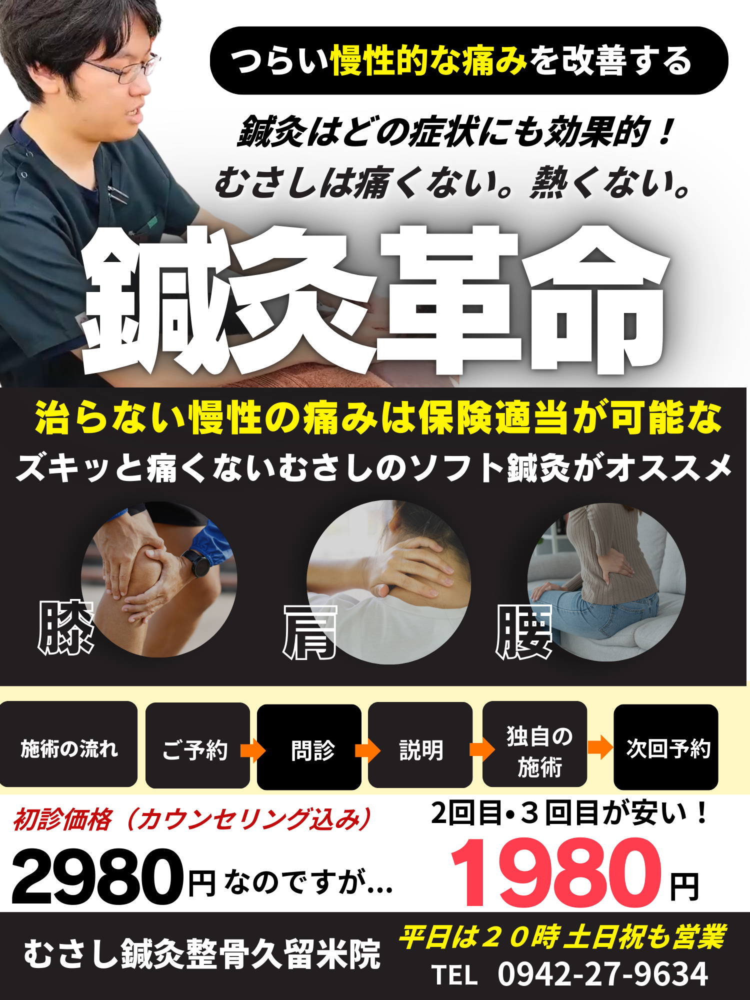 鍼灸革命。痛くない・熱くないソフトな鍼灸