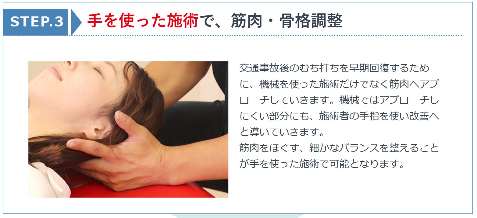 交通事故後の手順
